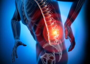 Le CBD, un anti douleur neuropathique de dos et arthrite